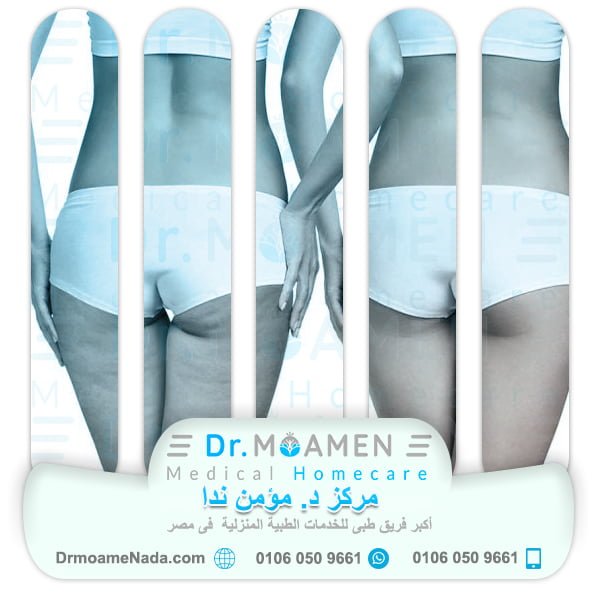 At-home non surgical cosmetic procedures to get rid of cellulite - Dr. Moamen Nada Center