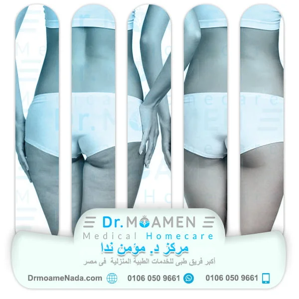 Home Cosmetic Surgery Service (non-surgical) 11 At-home non surgical cosmetic procedures to get rid of cellulite - Dr. Moamen Nada Center
