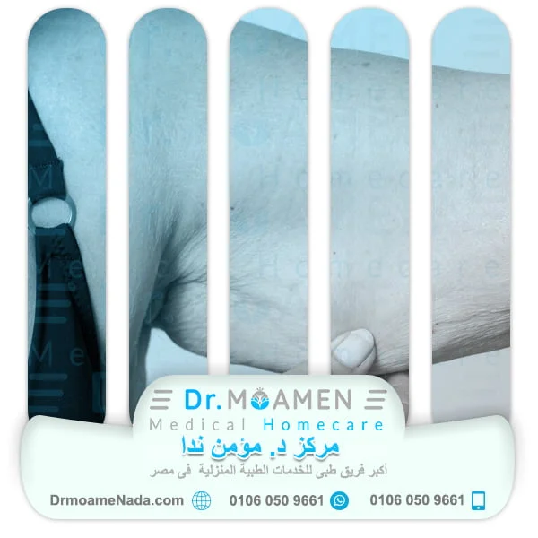 Home Cosmetic Surgery Service (non-surgical) 13 At-home non-surgical cosmetic procedures to get rid of sagging - Dr. Moamen Nada Center