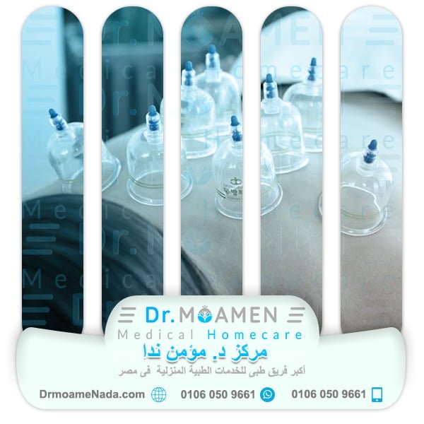 Cupping Therapy Cost - Dr. Moamen Nada Center