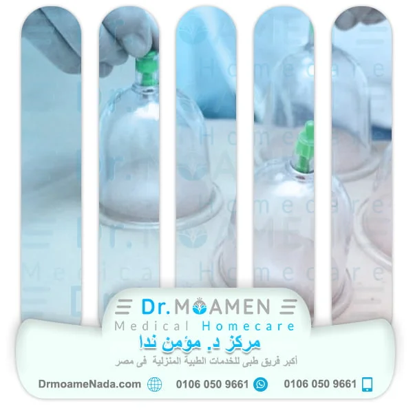 The Advantages of Cupping Therapy at Home by Dr. Moamen Nada Center