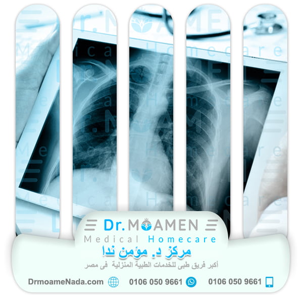 X-rays at Home - Dr. Moamen Nada Center