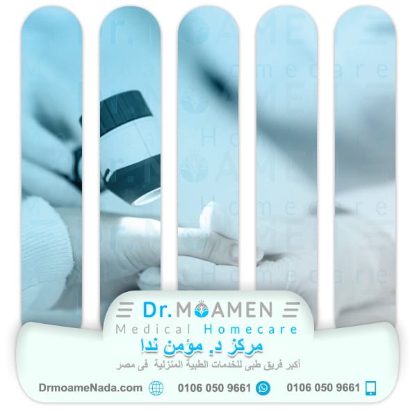 اسعار دكتور جلدية زيارة منزلية في مصر 2022 - مركز دكتور مؤمن ندا
