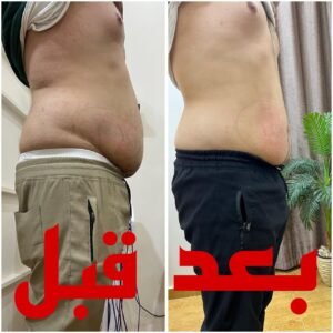 نتائج خدمة التغذية العلاجية مركز دكتور مؤمن ندا 6 - مركز دكتور مؤمن ندا